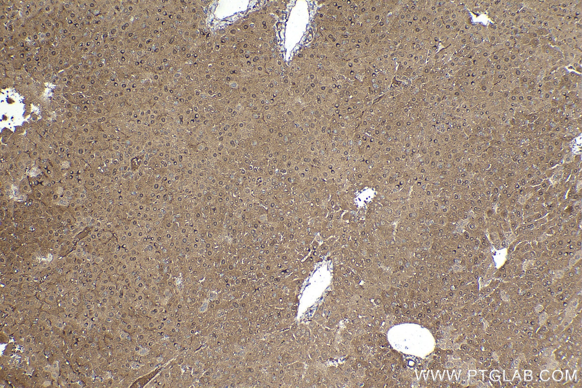 Immunohistochemical analysis of paraffin-embedded mouse liver tissue slide using KHC1789 (CC2D1A IHC Kit).