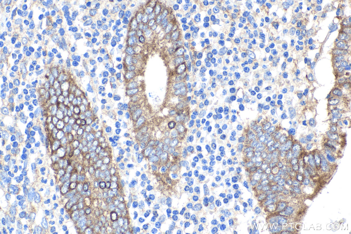 Immunohistochemical analysis of paraffin-embedded human appendicitis tissue slide using KHC1789 (CC2D1A IHC Kit).