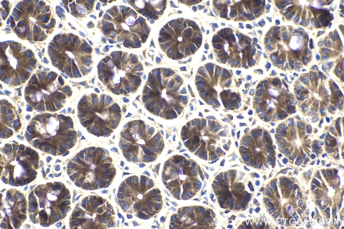 Immunohistochemical analysis of paraffin-embedded mouse small intestine tissue slide using KHC1789 (CC2D1A IHC Kit).