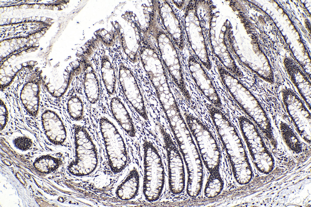 Immunohistochemical analysis of paraffin-embedded human colon tissue slide using KHC1377 (CCAR1 IHC Kit).