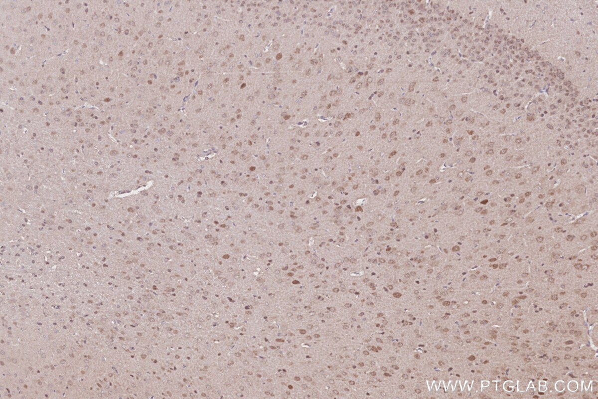 Immunohistochemical analysis of paraffin-embedded rat brain tissue slide using KHC2810 (CCDC115 IHC Kit).
