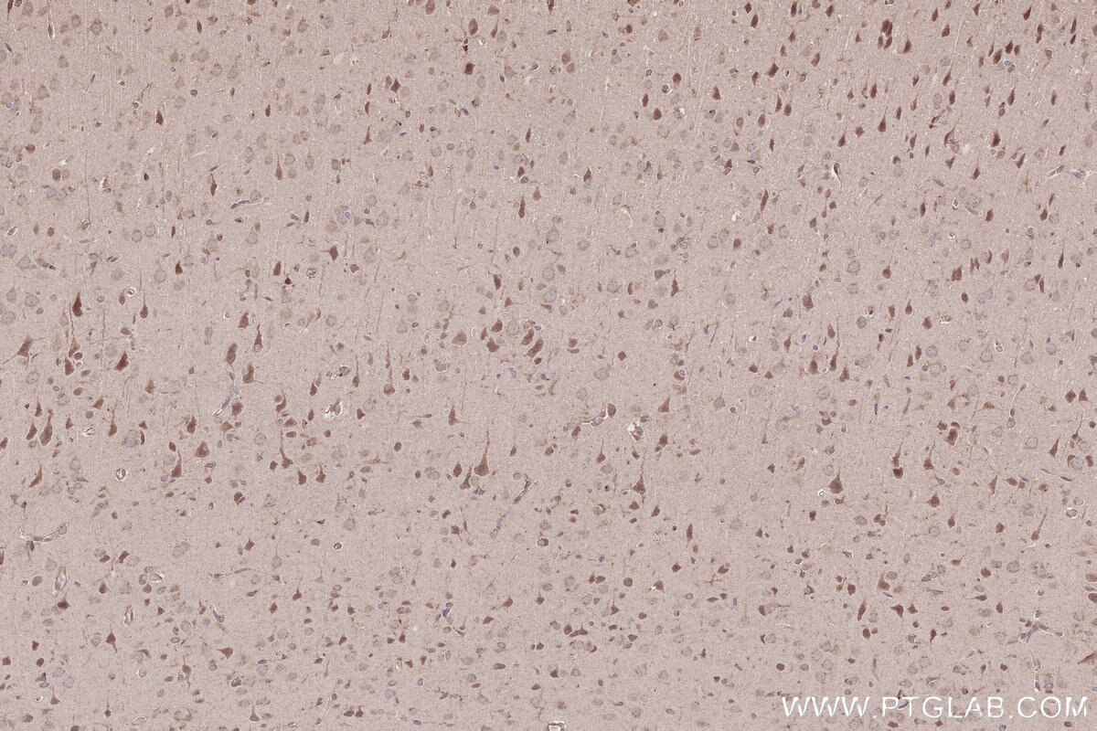 Immunohistochemical analysis of paraffin-embedded rat brain tissue slide using KHC2787 (CCDC99 IHC Kit).