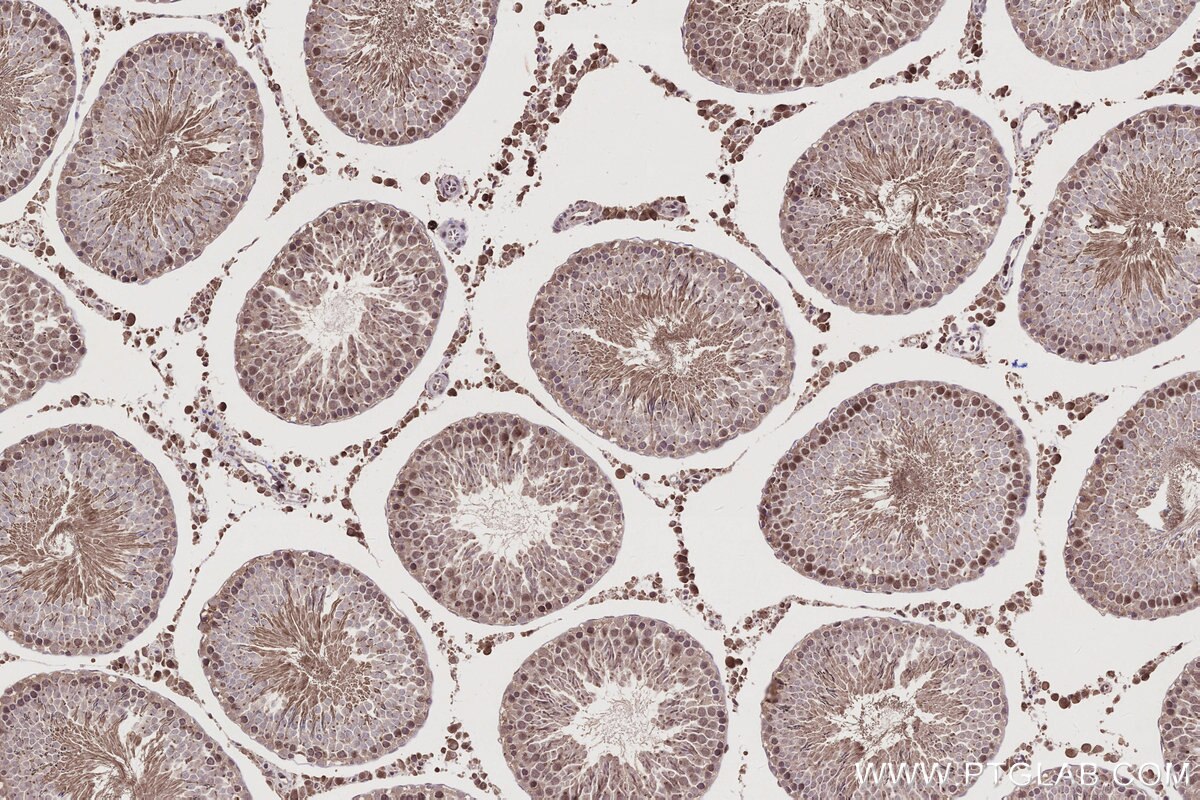 Immunohistochemical analysis of paraffin-embedded rat testis tissue slide using KHC2787 (CCDC99 IHC Kit).