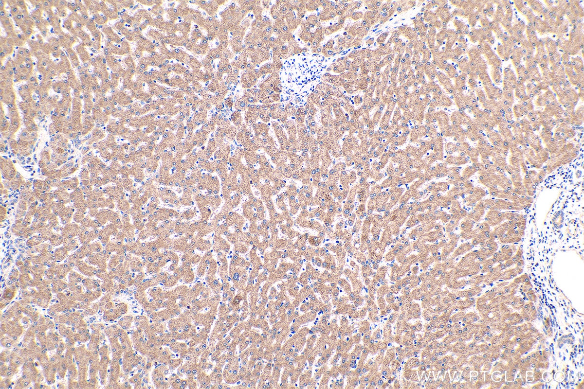 Immunohistochemical analysis of paraffin-embedded human liver tissue slide using KHC0407 (CCL20/MIP3A IHC Kit).