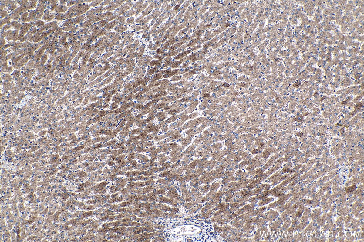 Immunohistochemical analysis of paraffin-embedded human liver tissue slide using KHC1174 (CCM3/PDCD10 IHC Kit).