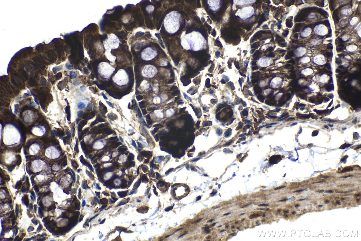 Immunohistochemical analysis of paraffin-embedded mouse colon tissue slide using KHC1174 (CCM3/PDCD10 IHC Kit).