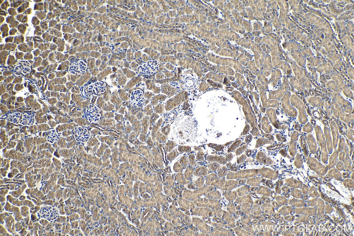 Immunohistochemical analysis of paraffin-embedded mouse kidney tissue slide using KHC1174 (CCM3/PDCD10 IHC Kit).