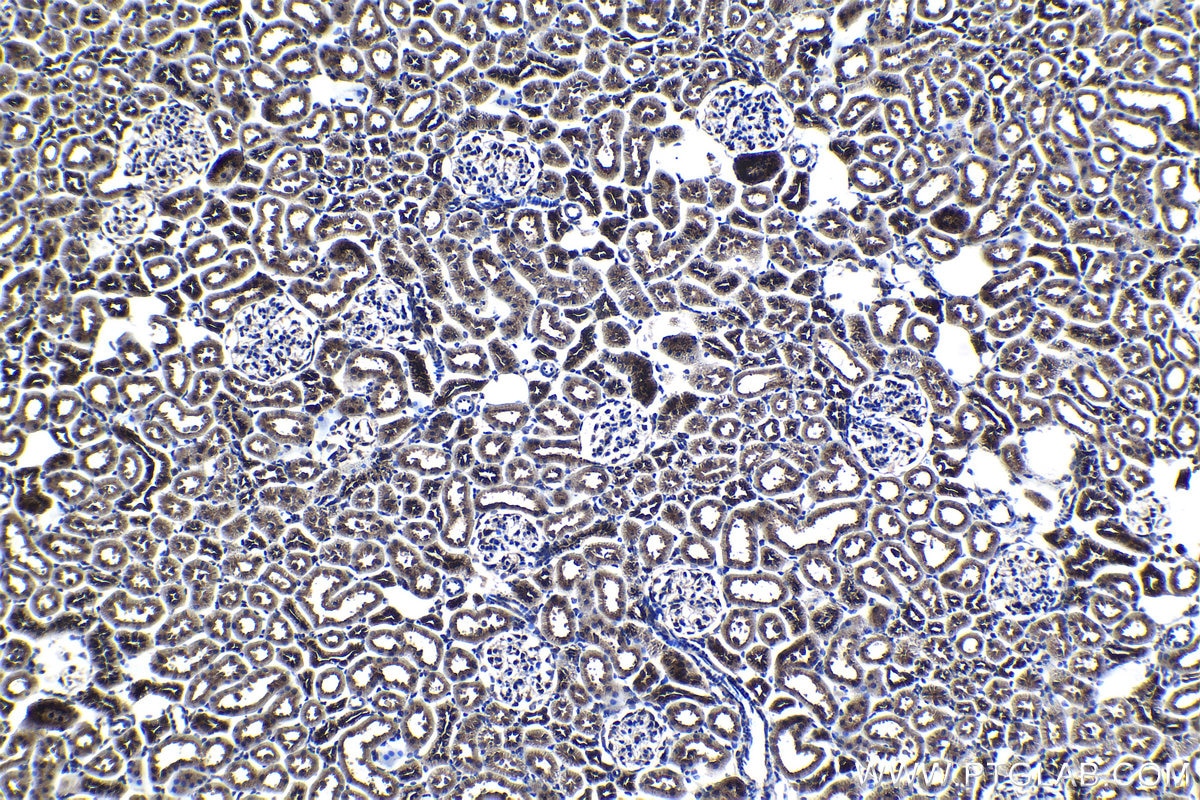 Immunohistochemical analysis of paraffin-embedded rat kidney tissue slide using KHC1174 (CCM3/PDCD10 IHC Kit).