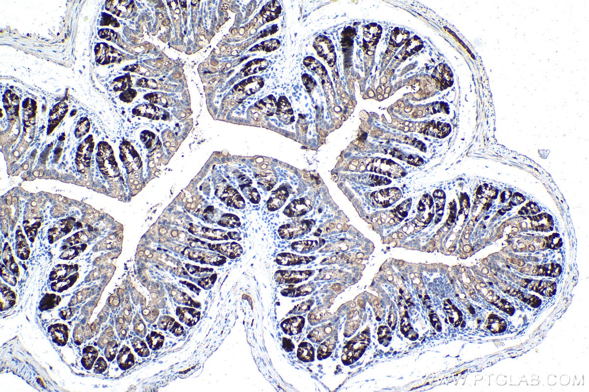 Immunohistochemical analysis of paraffin-embedded mouse colon tissue slide using KHC1548 (CCNA2 IHC Kit).