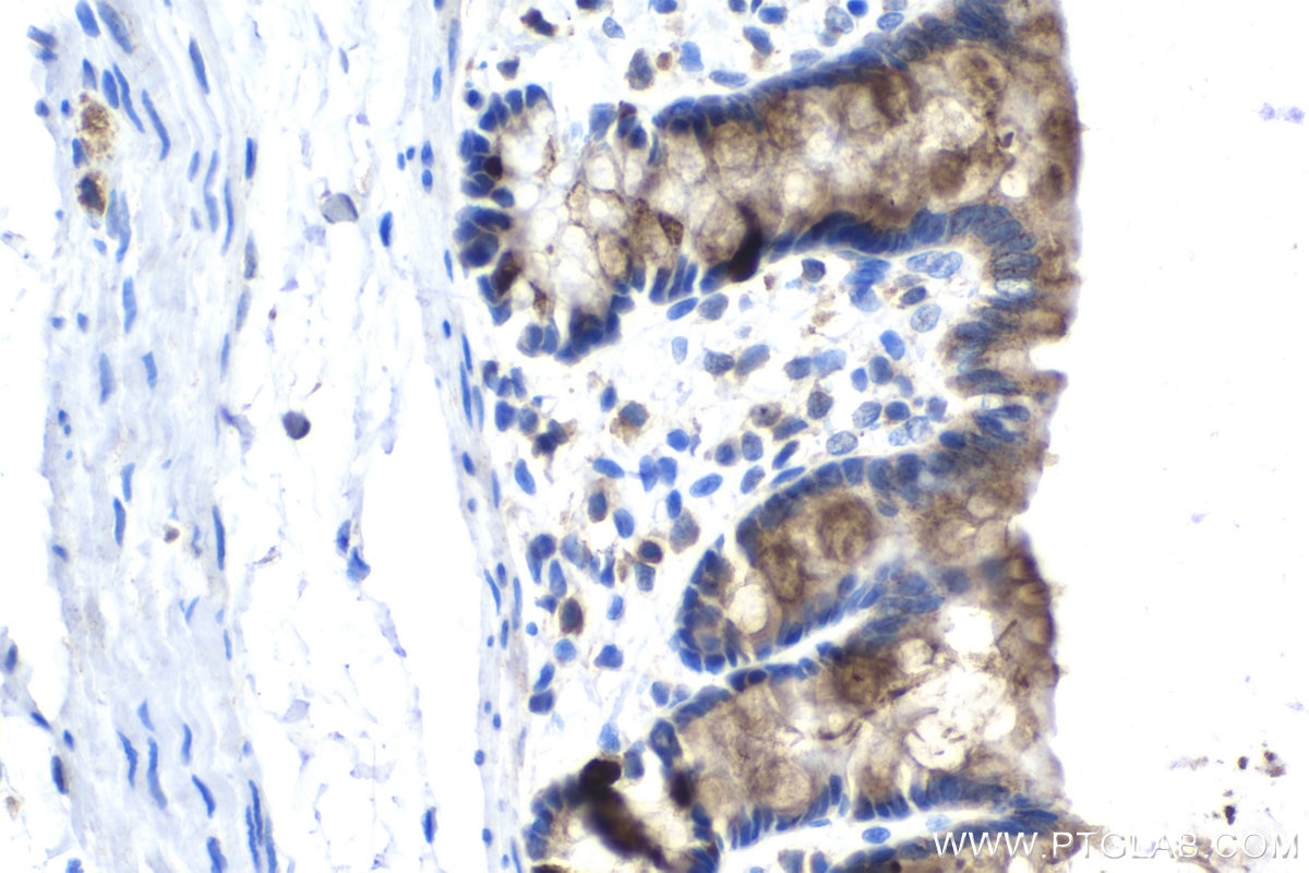 Immunohistochemical analysis of paraffin-embedded rat colon tissue slide using KHC1548 (CCNA2 IHC Kit).