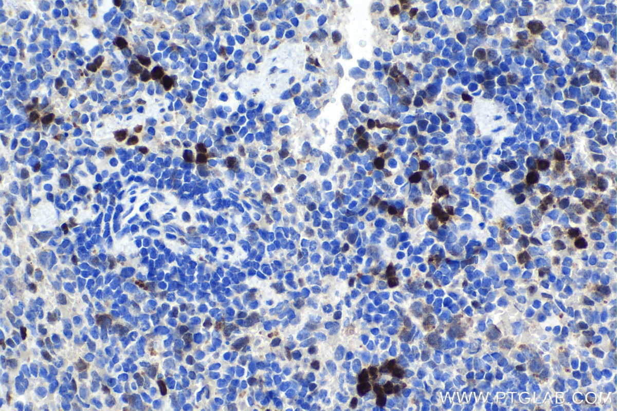 Immunohistochemical analysis of paraffin-embedded mouse spleen tissue slide using KHC1605 (CCND3 IHC Kit).