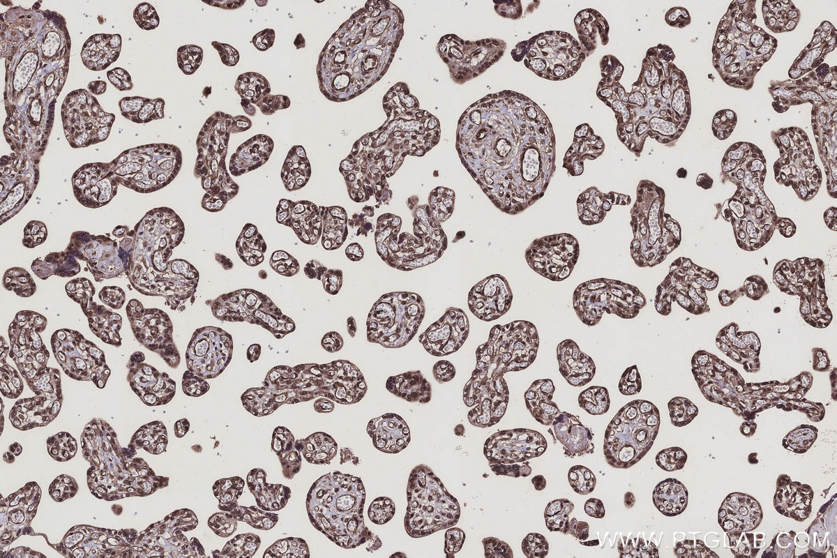 Immunohistochemical analysis of paraffin-embedded human placenta tissue slide using KHC3127 (CCNI2 IHC Kit).