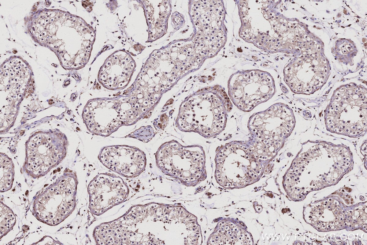 Immunohistochemical analysis of paraffin-embedded human testis tissue slide using KHC3126 (CCNJ IHC Kit).