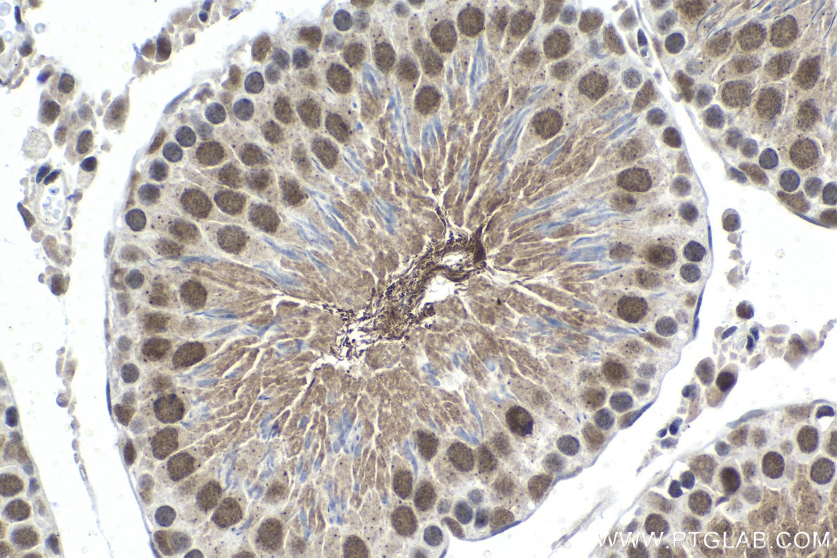 Immunohistochemical analysis of paraffin-embedded rat testis tissue slide using KHC1479 (CCNK IHC Kit).