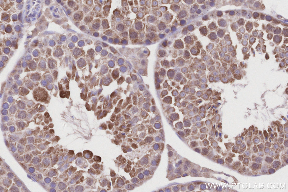 Immunohistochemical analysis of paraffin-embedded mouse testis tissue slide using KHC3222 (CCT4 IHC Kit).