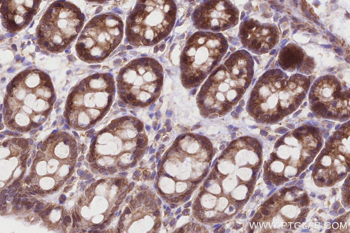 Immunohistochemical analysis of paraffin-embedded rat colon tissue slide using KHC3222 (CCT4 IHC Kit).