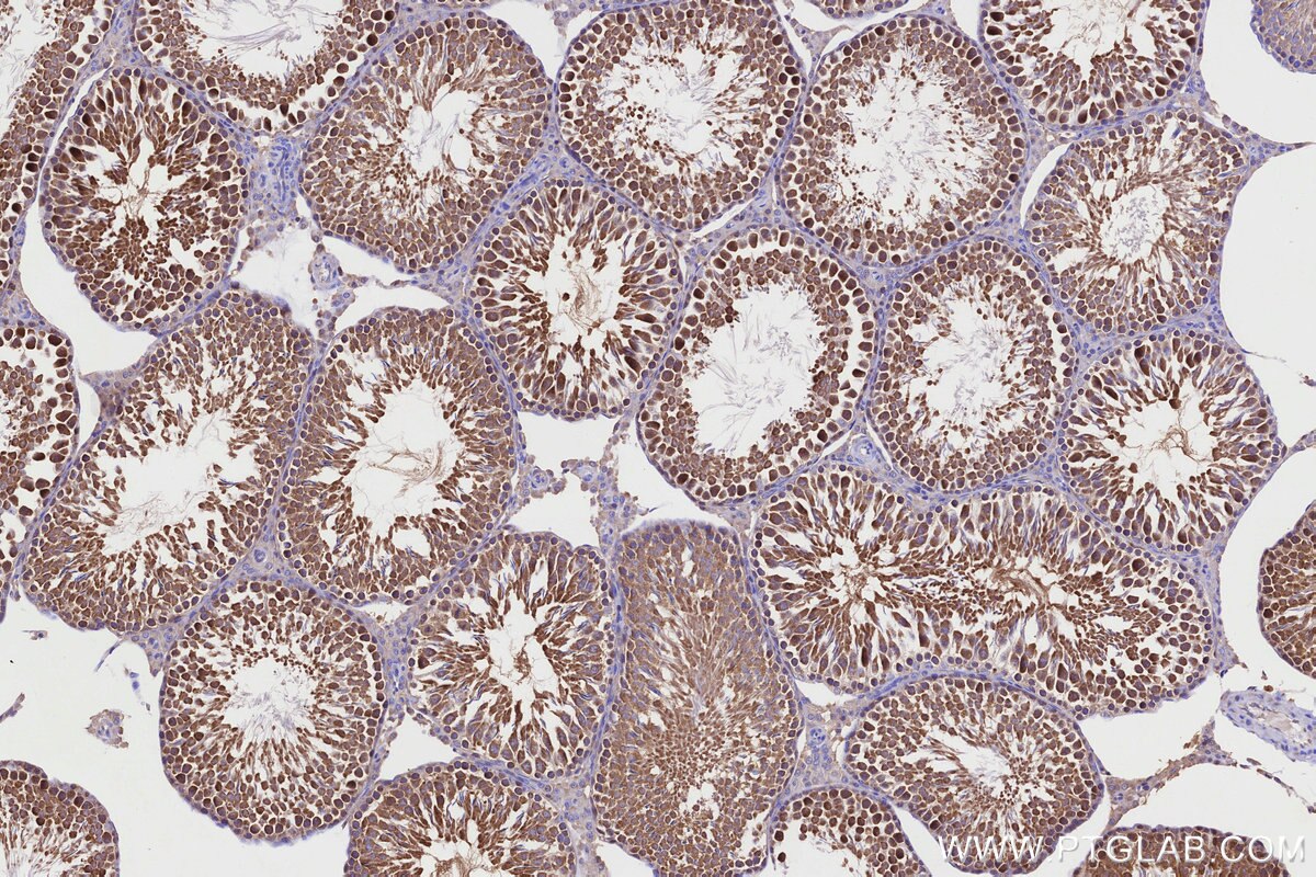 Immunohistochemical analysis of paraffin-embedded rat testis tissue slide using KHC3222 (CCT4 IHC Kit).