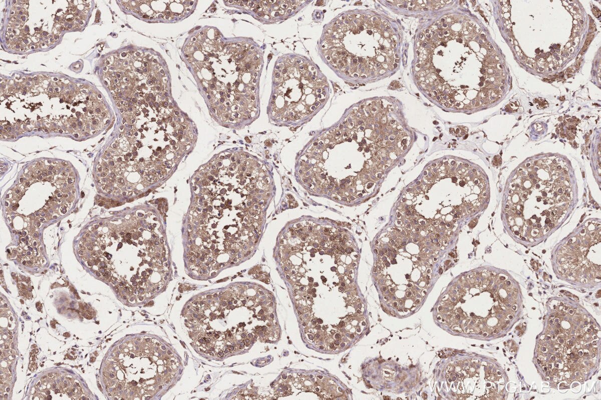 Immunohistochemical analysis of paraffin-embedded human testis tissue slide using KHC3304 (CCT6B IHC Kit).
