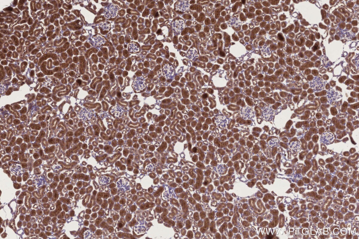 Immunohistochemical analysis of paraffin-embedded mouse kidney tissue slide using KHC3304 (CCT6B IHC Kit).