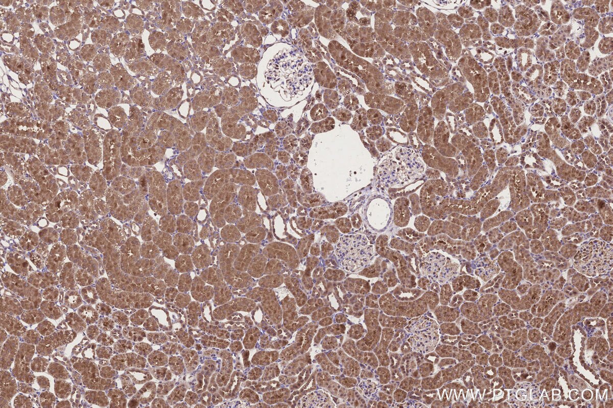 Immunohistochemical analysis of paraffin-embedded rat kidney tissue slide using KHC3304 (CCT6B IHC Kit).