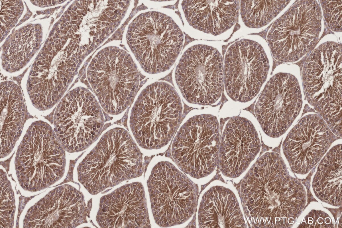 Immunohistochemical analysis of paraffin-embedded rat testis tissue slide using KHC3304 (CCT6B IHC Kit).