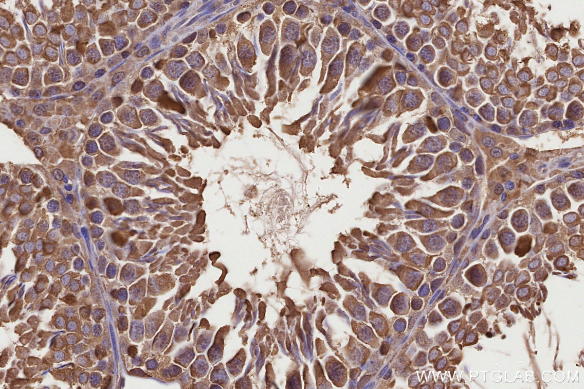 Immunohistochemical analysis of paraffin-embedded rat testis tissue slide using KHC3221 (CCT8 IHC Kit).