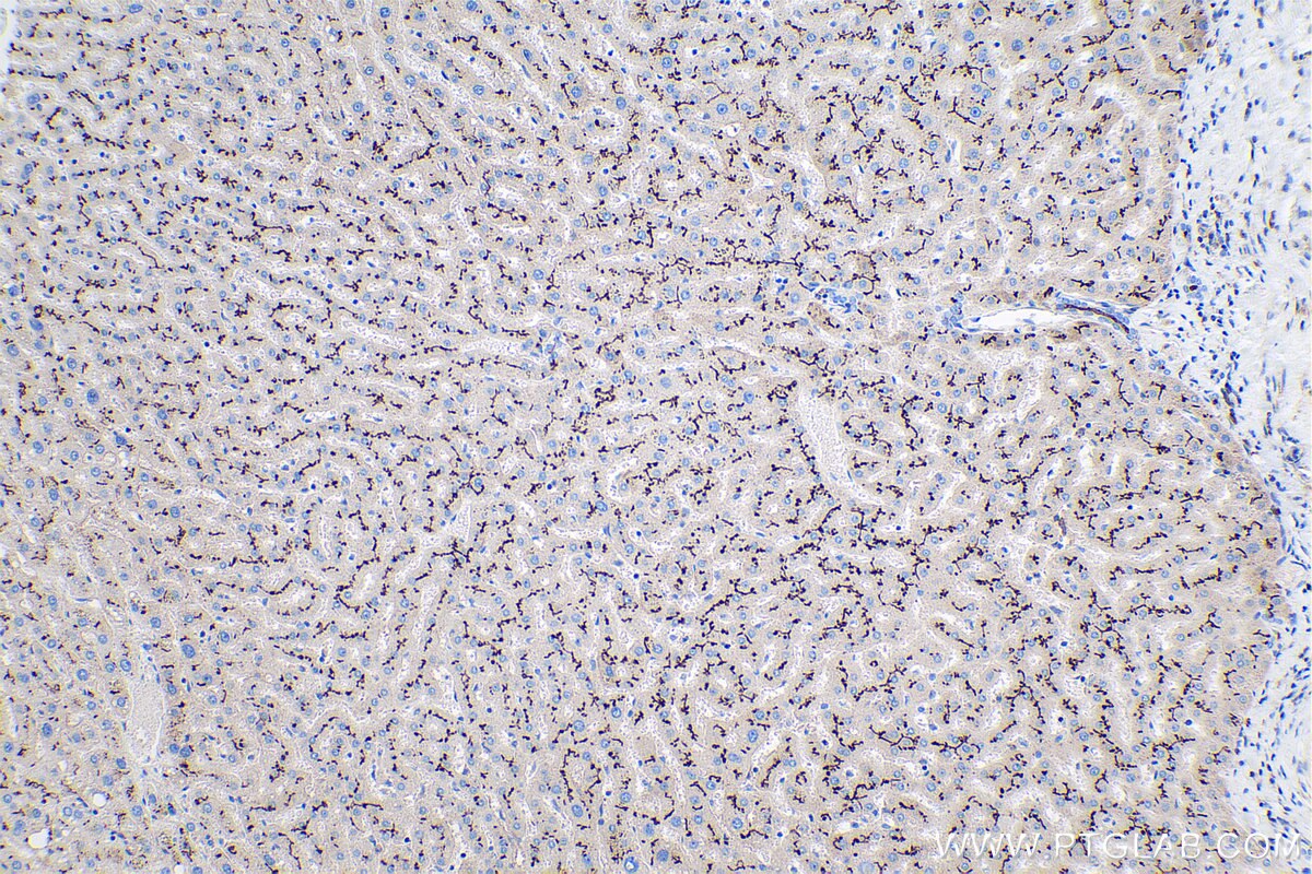 Immunohistochemical analysis of paraffin-embedded human liver tissue slide using KHC0386 (CD10 IHC Kit).