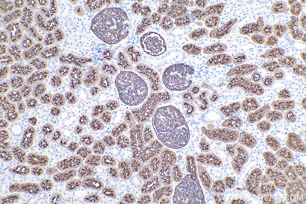 Immunohistochemical analysis of paraffin-embedded human kidney tissue slide using KHC0386 (CD10 IHC Kit).