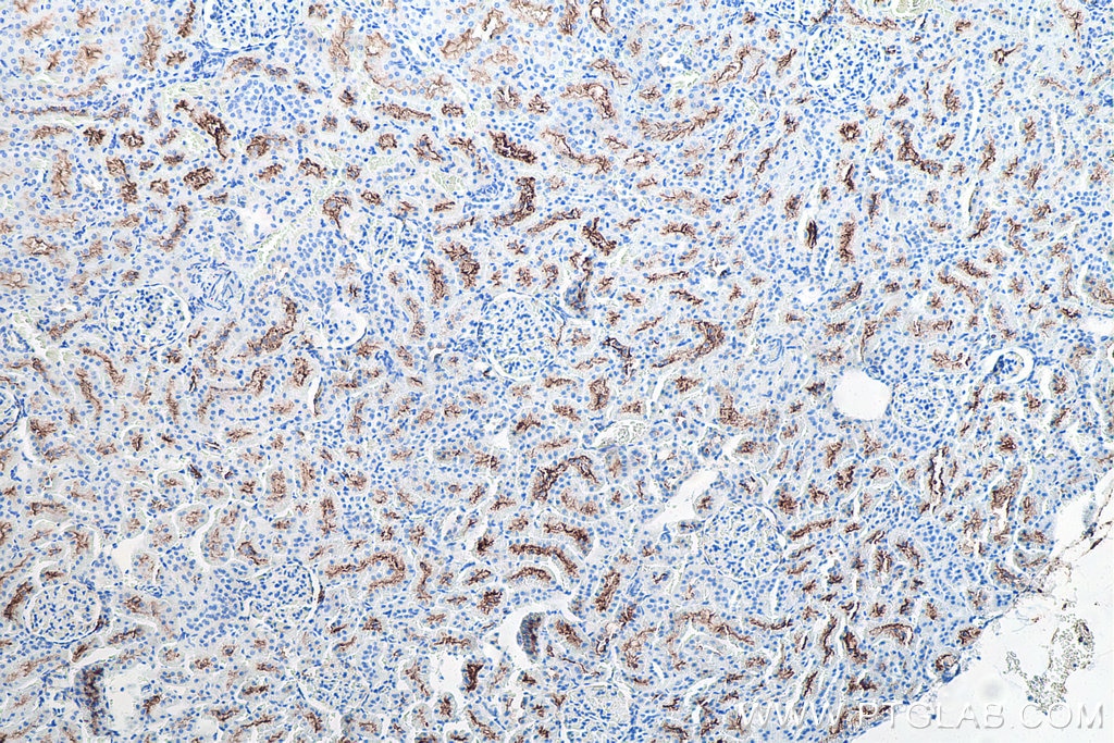 Immunohistochemical analysis of paraffin-embedded rat kidney tissue slide using KHC0026 (CD13 IHC Kit).