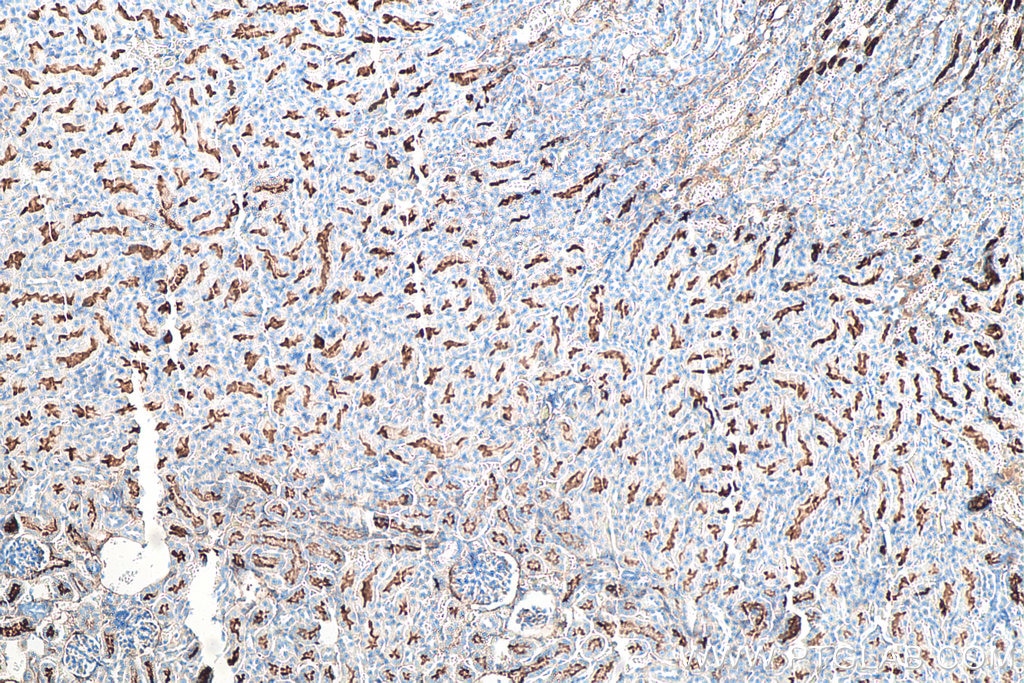 Immunohistochemical analysis of paraffin-embedded mouse kidney tissue slide using KHC0026 (CD13 IHC Kit).