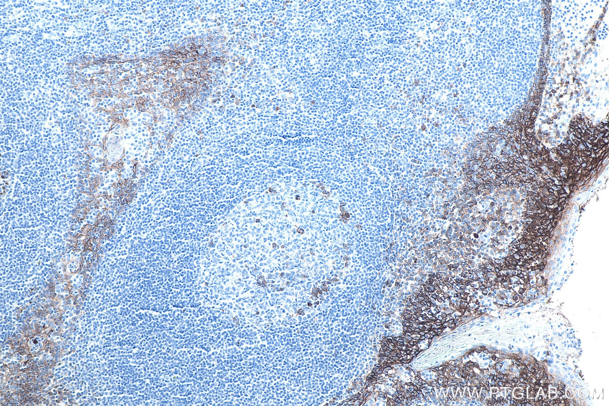 Immunohistochemical analysis of paraffin-embedded human tonsillitis tissue slide using KHC0020 (CD138/SDC1 IHC Kit).