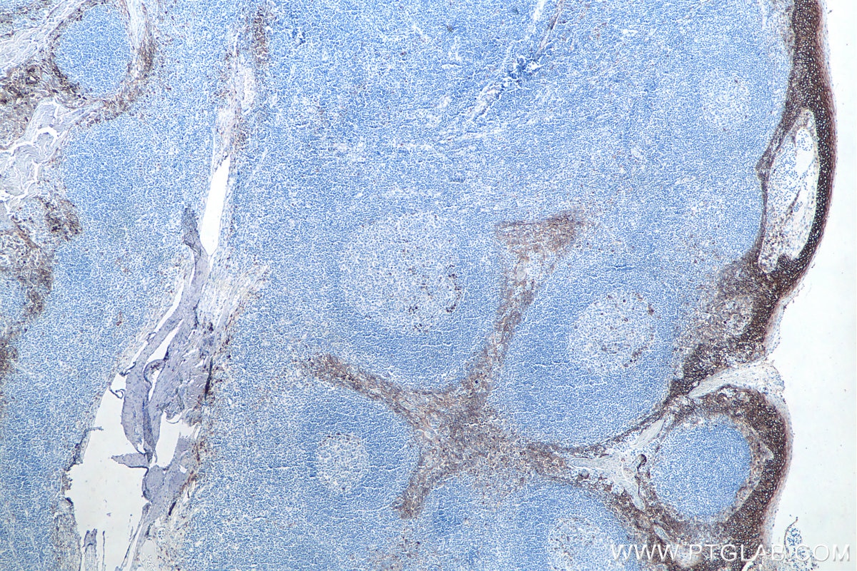 Immunohistochemical analysis of paraffin-embedded human tonsillitis tissue slide using KHC0020 (CD138/SDC1 IHC Kit).