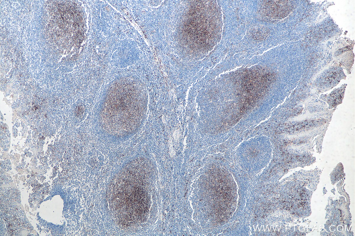 Immunohistochemical analysis of paraffin-embedded human tonsillitis tissue slide using KHC0028 (CD14 IHC Kit).