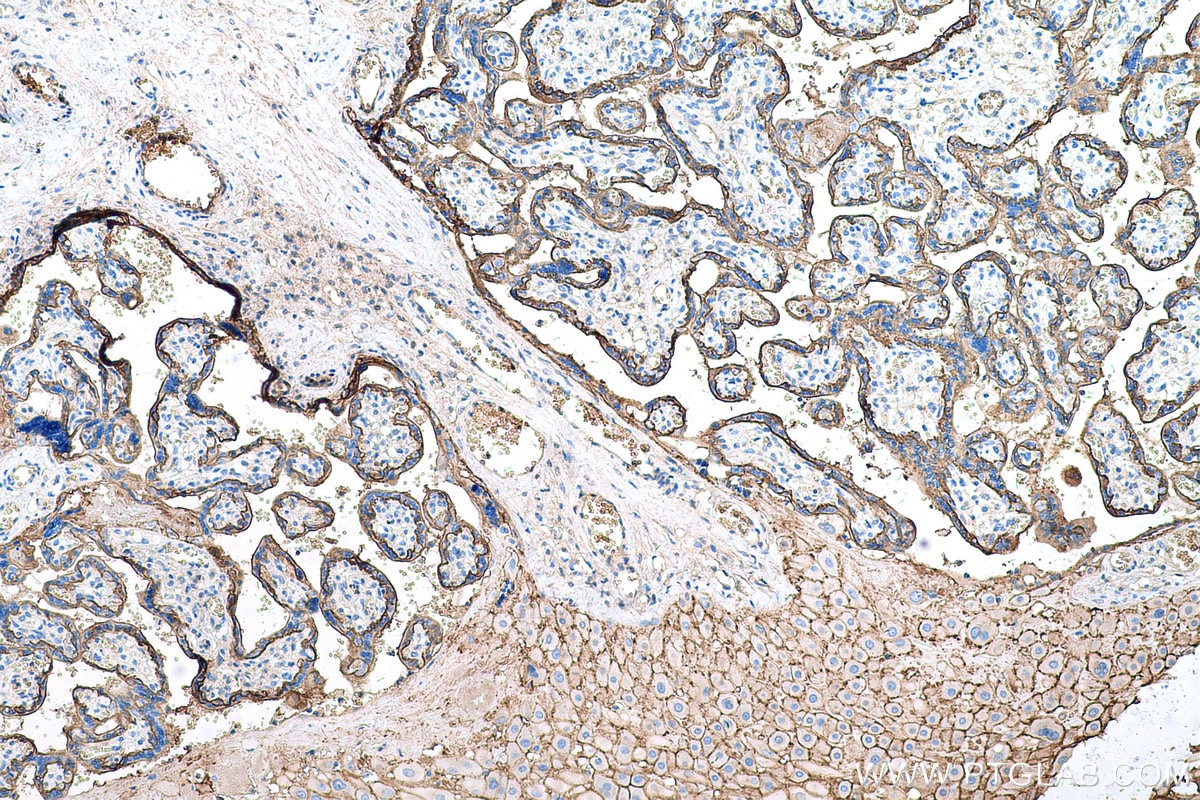 Immunohistochemical analysis of paraffin-embedded human placenta tissue slide using KHC0607 (CD147/BSG IHC Kit).