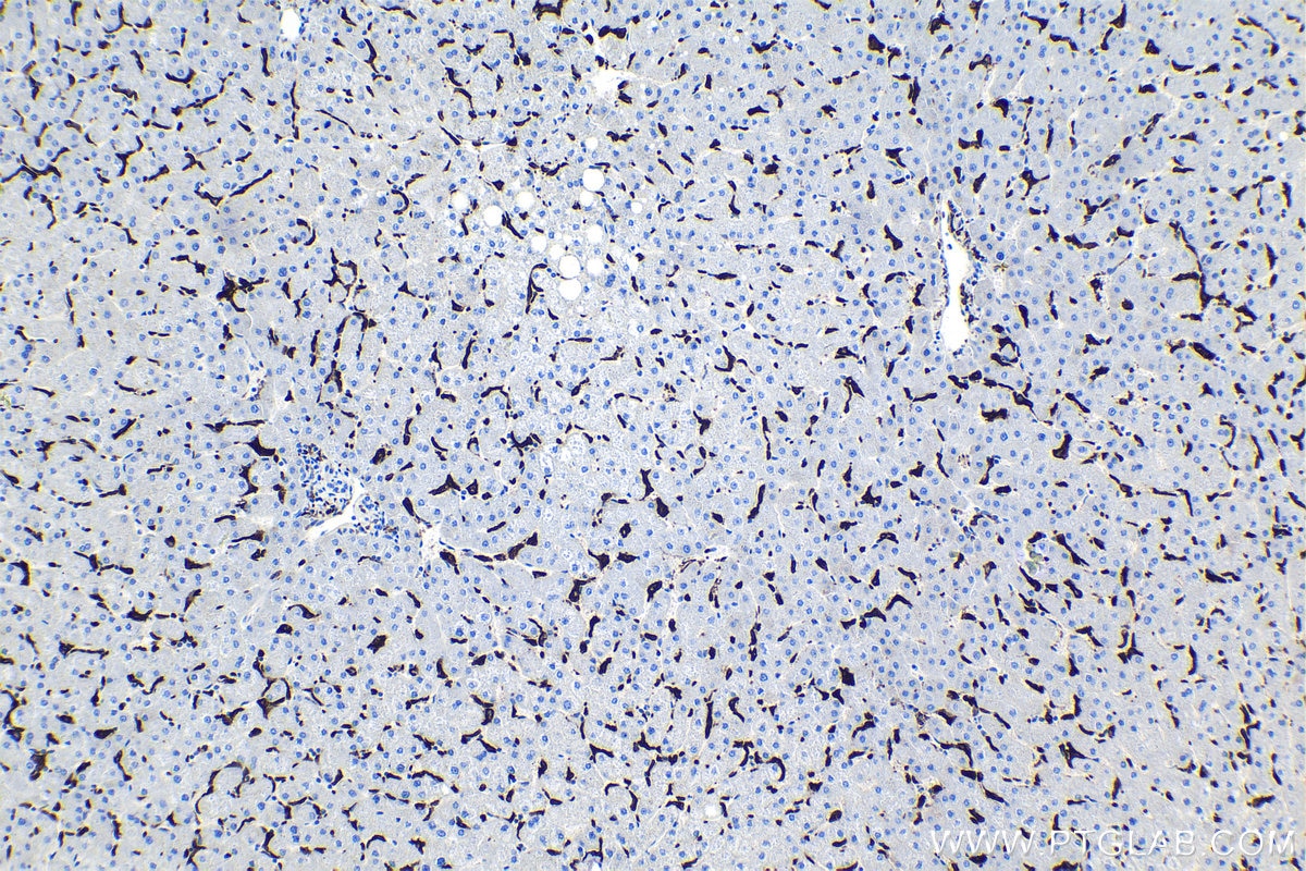 Immunohistochemical analysis of paraffin-embedded human liver tissue slide using KHC0942 (CD163 IHC Kit).