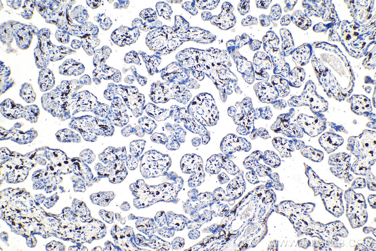 Immunohistochemical analysis of paraffin-embedded human placenta tissue slide using KHC0942 (CD163 IHC Kit).