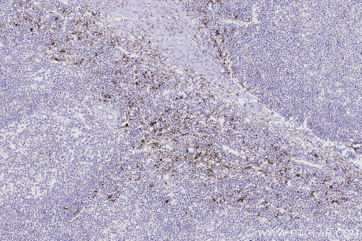Immunohistochemical analysis of paraffin-embedded human tonsillitis tissue slide using KHC2961 (CD209 IHC Kit).