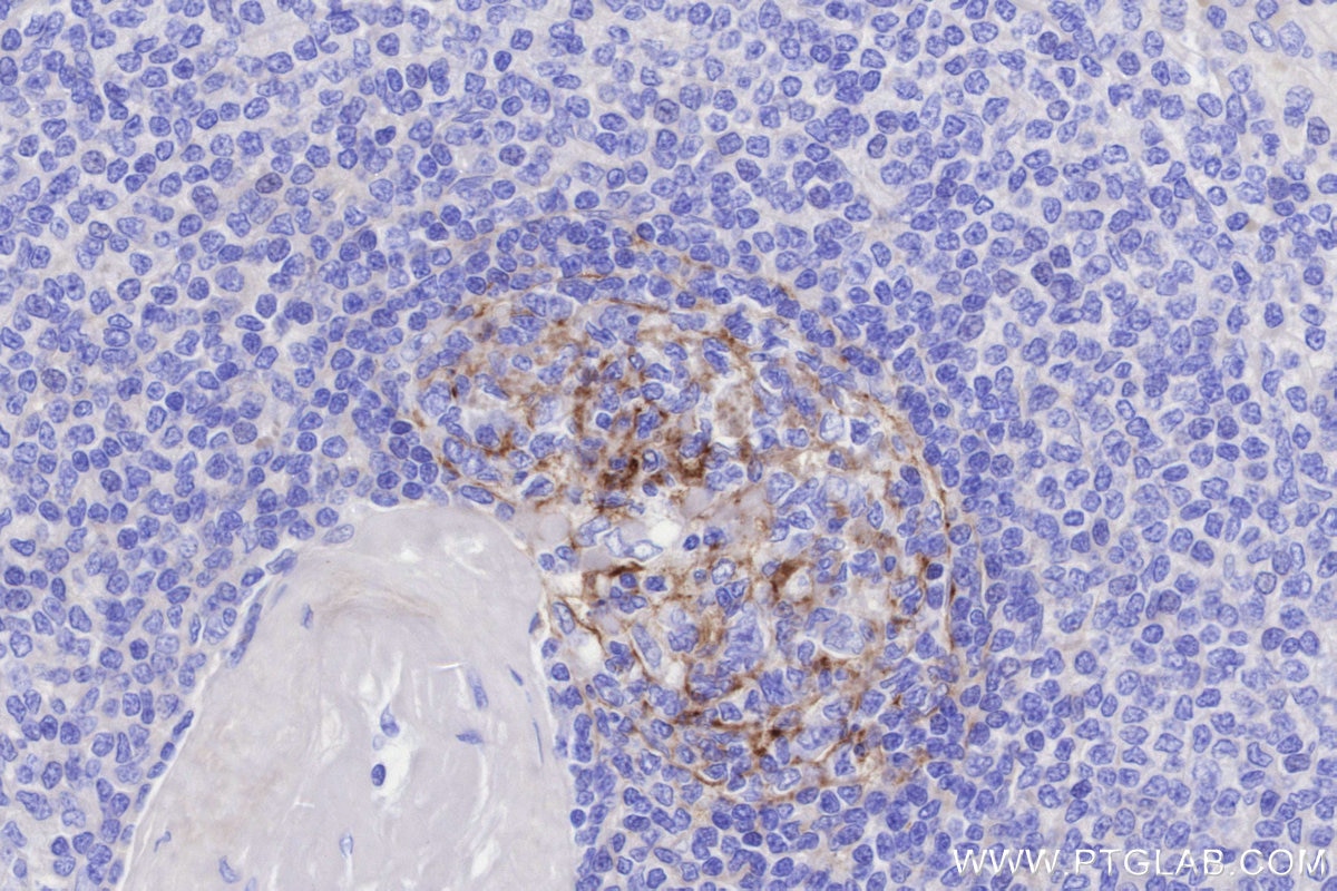 Immunohistochemical analysis of paraffin-embedded human spleen tissue slide using KHC3310 (CD21 IHC Kit).