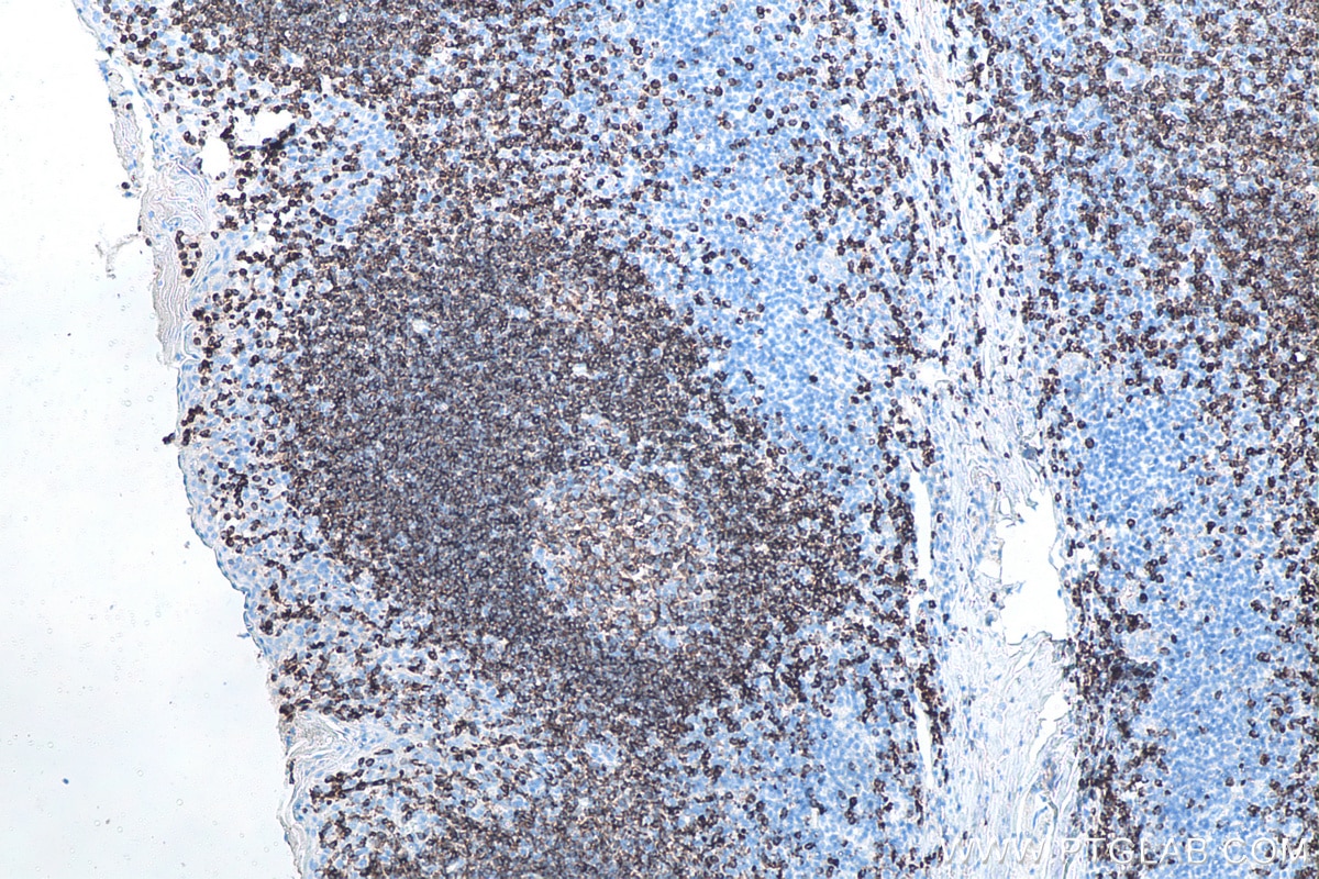 Immunohistochemical analysis of paraffin-embedded human tonsillitis tissue slide using KHC0019 (CD22 IHC Kit).