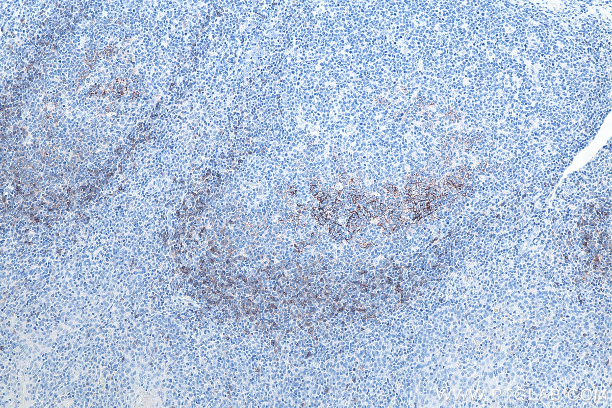 Immunohistochemical analysis of paraffin-embedded human tonsillitis tissue slide using KHC0021 (CD23 IHC Kit).