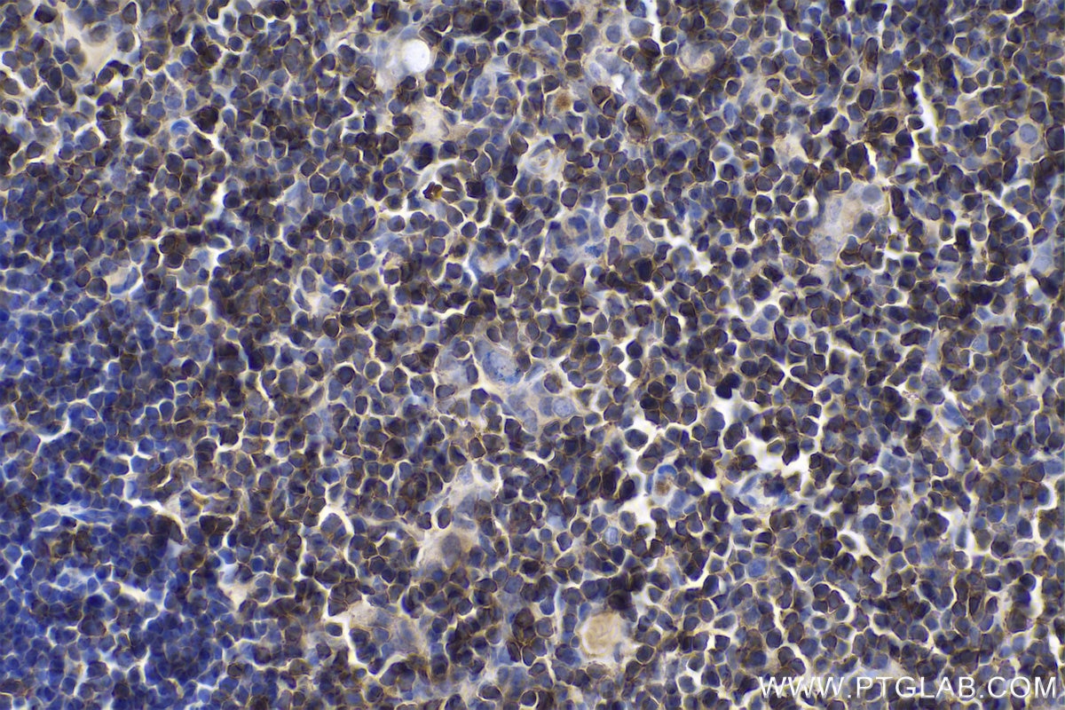 Immunohistochemical analysis of paraffin-embedded mouse thymus tissue slide using KHC0608 (CD247 IHC Kit).