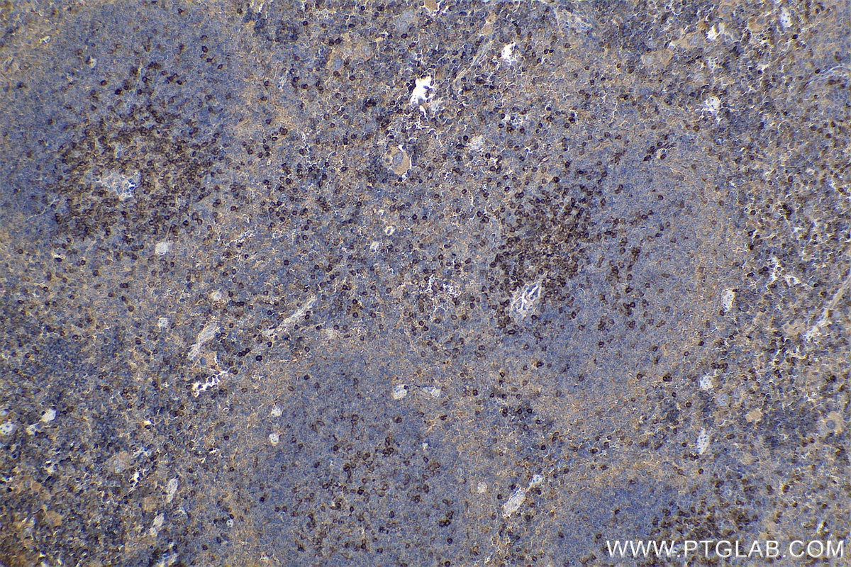 Immunohistochemical analysis of paraffin-embedded mouse spleen tissue slide using KHC0608 (CD247 IHC Kit).
