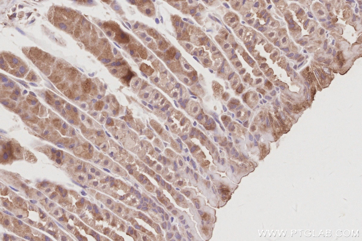 Immunohistochemical analysis of paraffin-embedded mouse stomach tissue slide using KHC3079 (CD2AP IHC Kit). Immunohistochemical analysis of paraffin-embedded mouse stomach tissue slide using KHC3079 (CD2AP IHC Kit).
