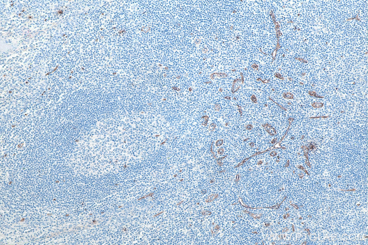 Immunohistochemical analysis of paraffin-embedded human tonsillitis tissue slide using KHC0023 (CD34 IHC Kit).