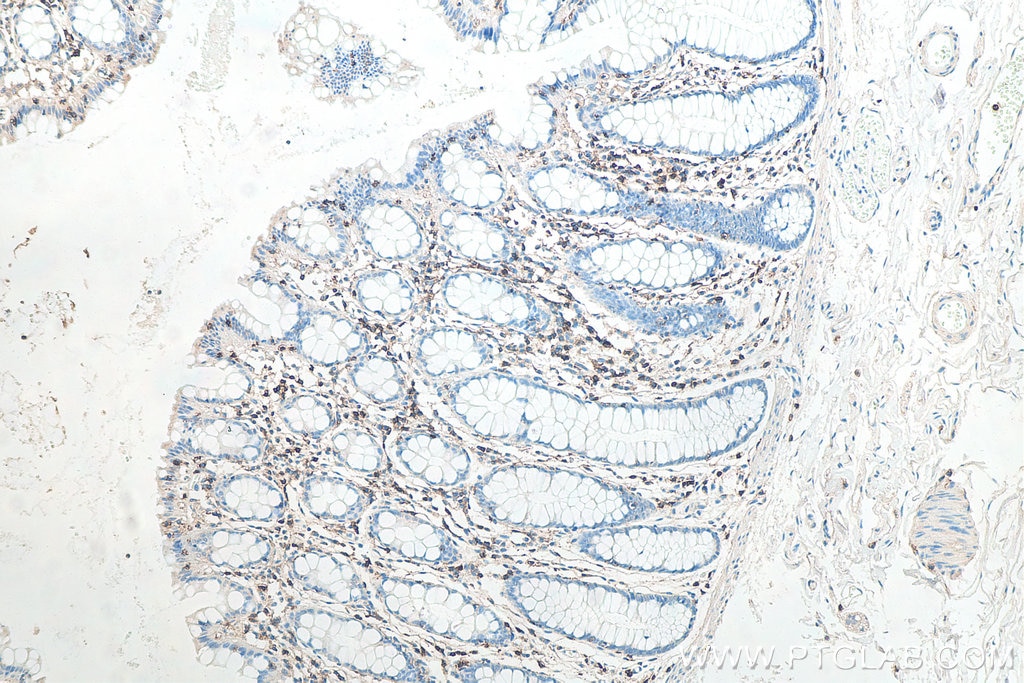 Immunohistochemical analysis of paraffin-embedded human colon tissue slide using KHC0015 (CD43 IHC Kit).