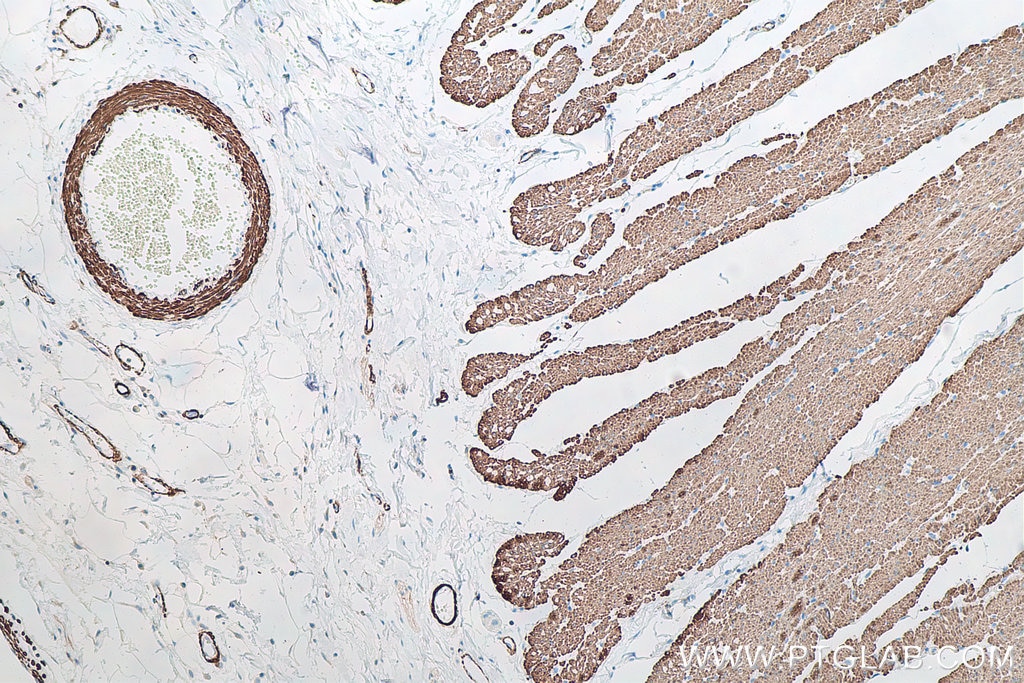 Immunohistochemical analysis of paraffin-embedded human colon cancer tissue slide using KHC0030 (CD44 IHC Kit). This view is captured from cancer adjacent normal tissue.