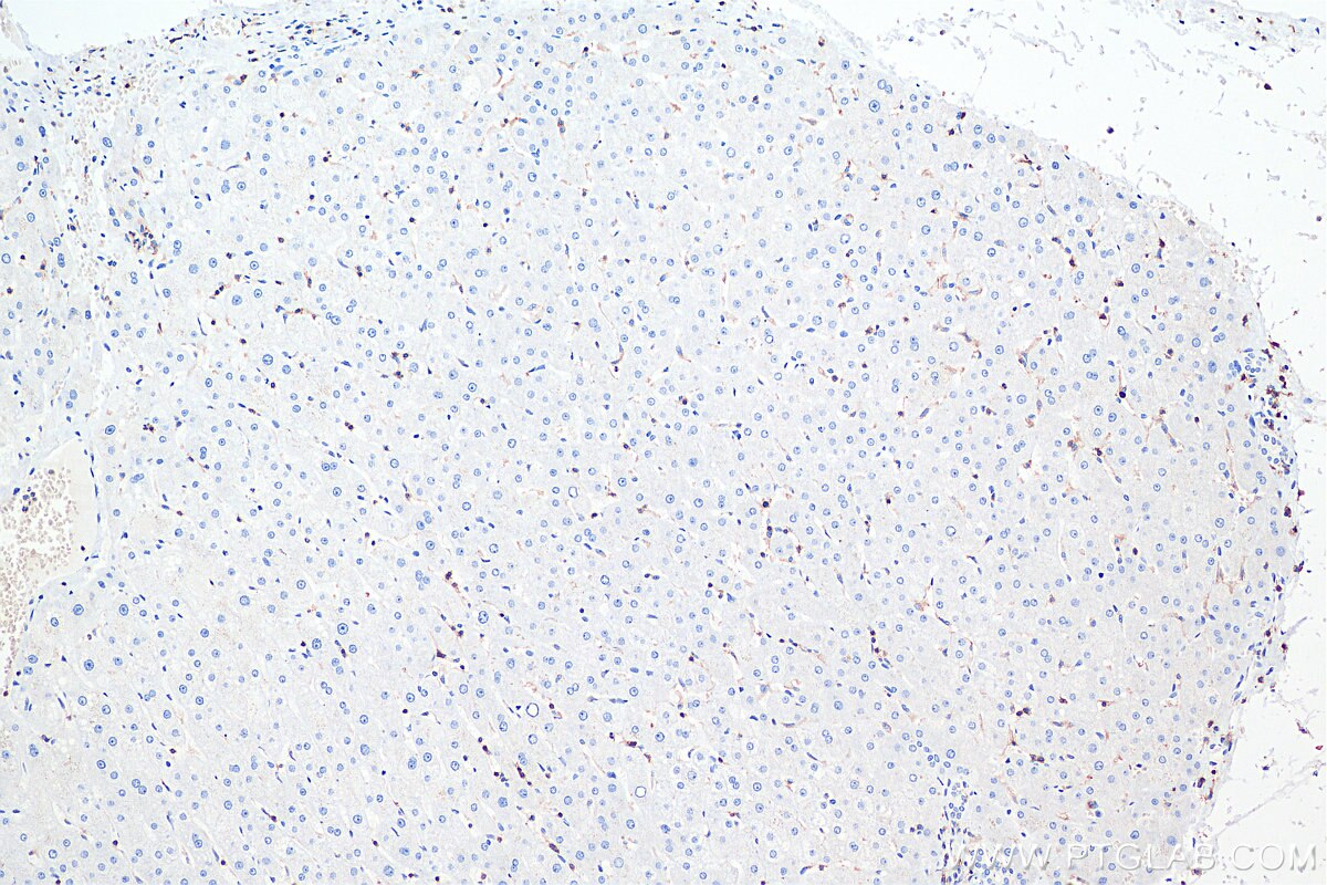 Immunohistochemical analysis of paraffin-embedded human liver tissue slide using KHC0031 (CD45 IHC Kit).