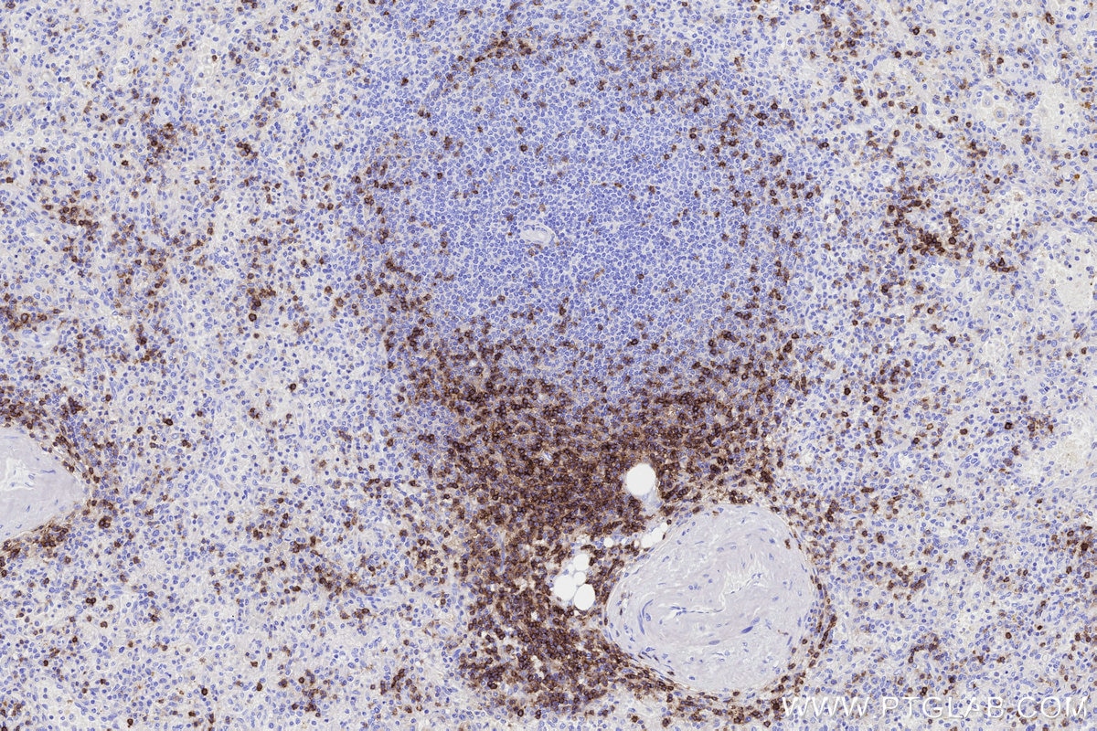 Immunohistochemical analysis of paraffin-embedded human spleen tissue slide using KHC3311 (CD5 IHC Kit). Immunohistochemical analysis of paraffin-embedded human spleen tissue slide using KHC3311 (CD5 IHC Kit).