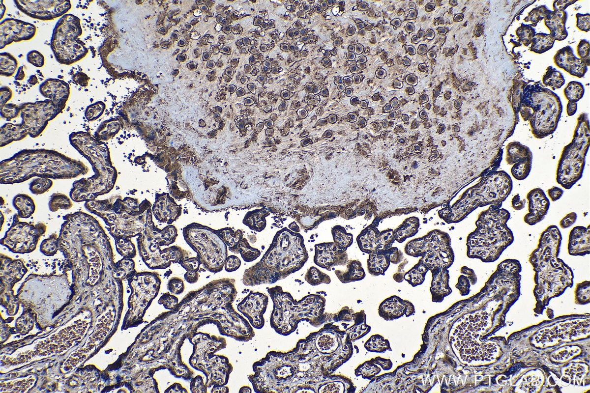 Immunohistochemical analysis of paraffin-embedded human placenta tissue slide using KHC1230 (CD59 IHC Kit).