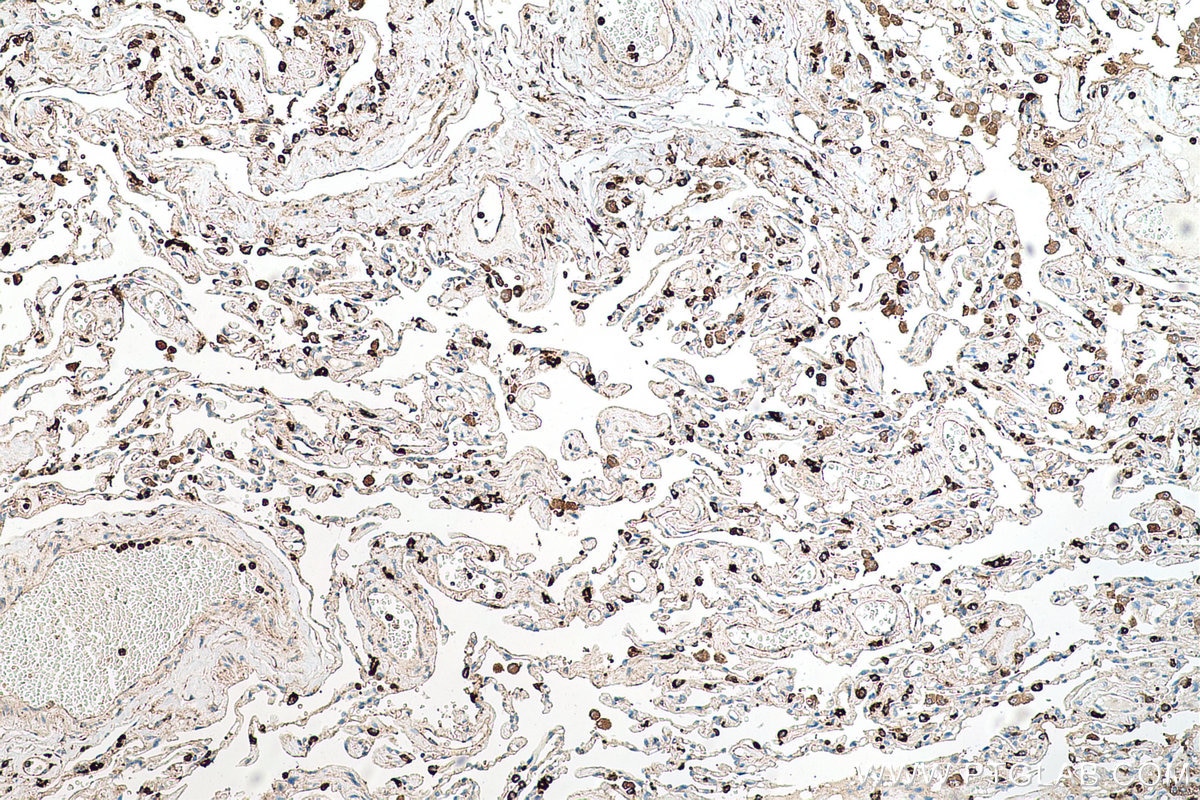 Immunohistochemical analysis of paraffin-embedded human lung cancer(NAT) tissue slide using KHC0722 (CD63 IHC Kit).